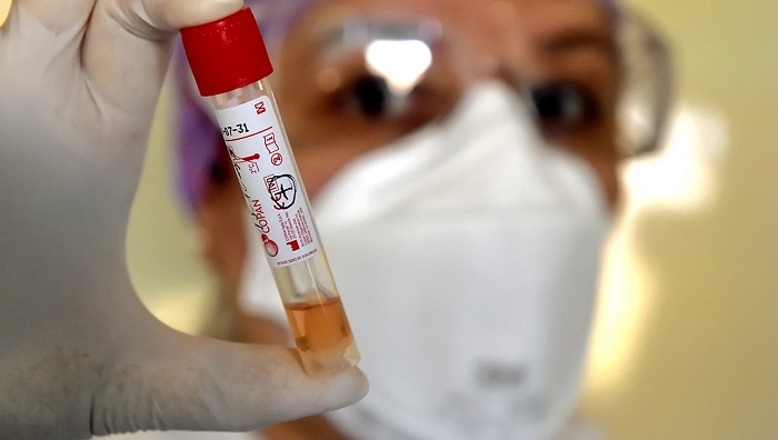 COVID A POZZUOLI/ Altri 29 contagiati a 15 guariti nelle ultime 24 ore