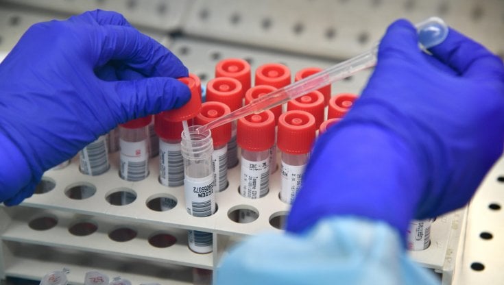 COVID A POZZUOLI/ Altri 25 contagiati e 5 guariti nelle ultime 24 ore