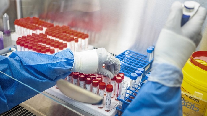 COVID A POZZUOLI/ Altri 57 contagiati nelle ultime 24 ore: positivo il 15% dei tamponi