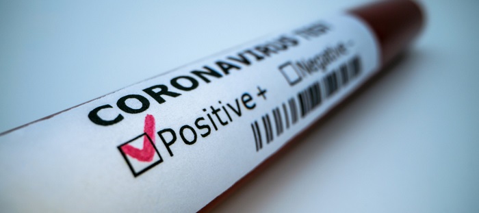 COVID A POZZUOLI/ Altri 13 contagiati e 5 guariti nelle ultime 24 ore