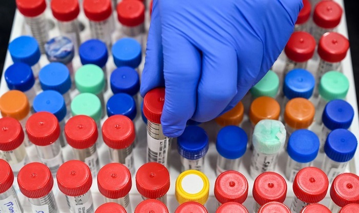 COVID A POZZUOLI/ Altri 101 contagiati e 86 guariti nelle ultime 24 ore